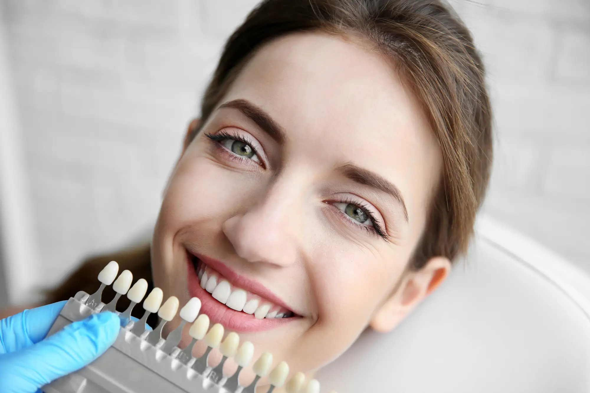 Shade Selection at Implant Dentist Franklinville