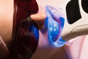 UV-Whitening-Procedure-for-Professional-Teeth-Whitening-NJ