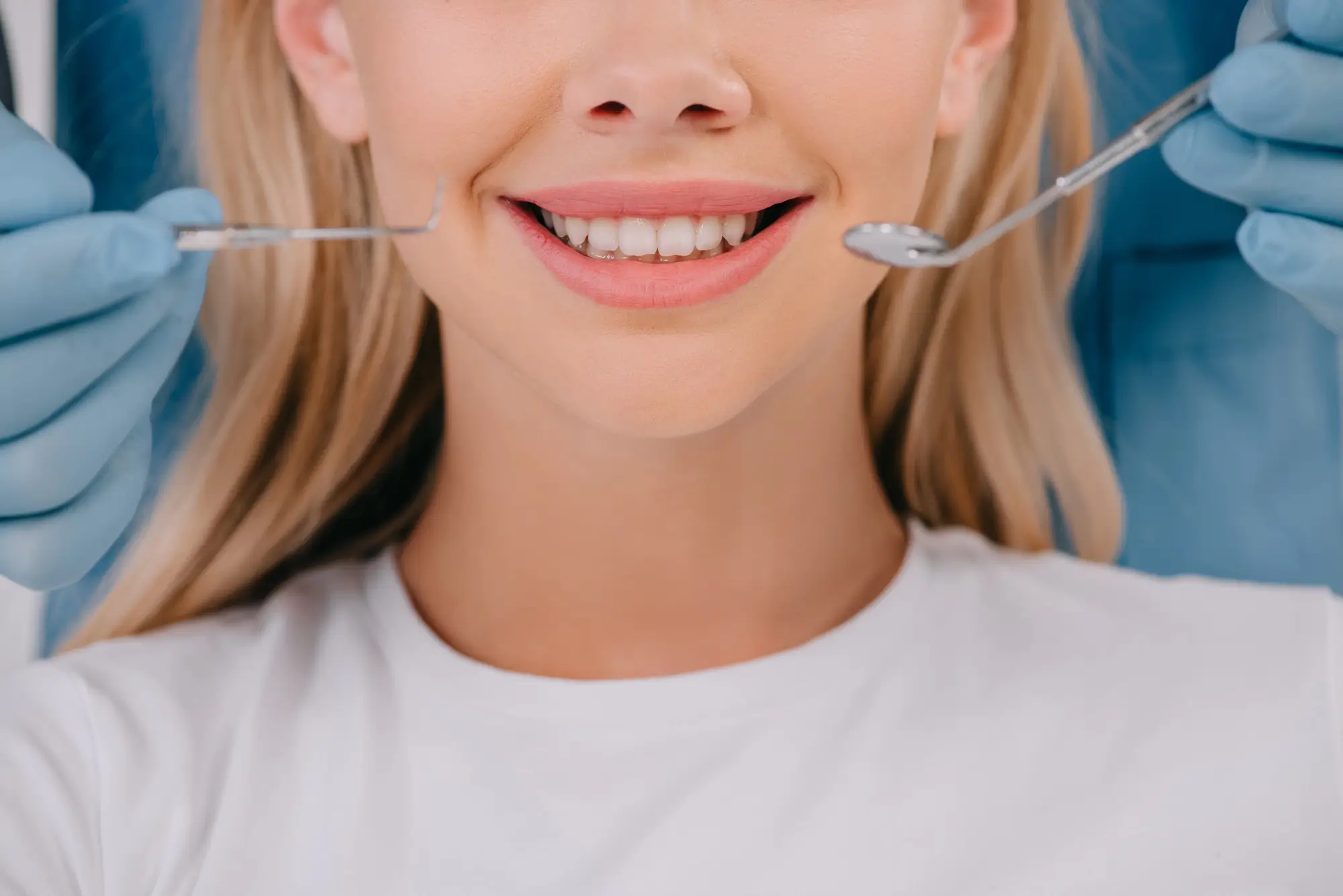 No Prep Veneers Consultation with Dentist