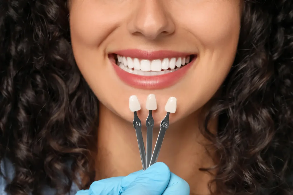Dentist checking tooth shade for Composite Veneers placement.