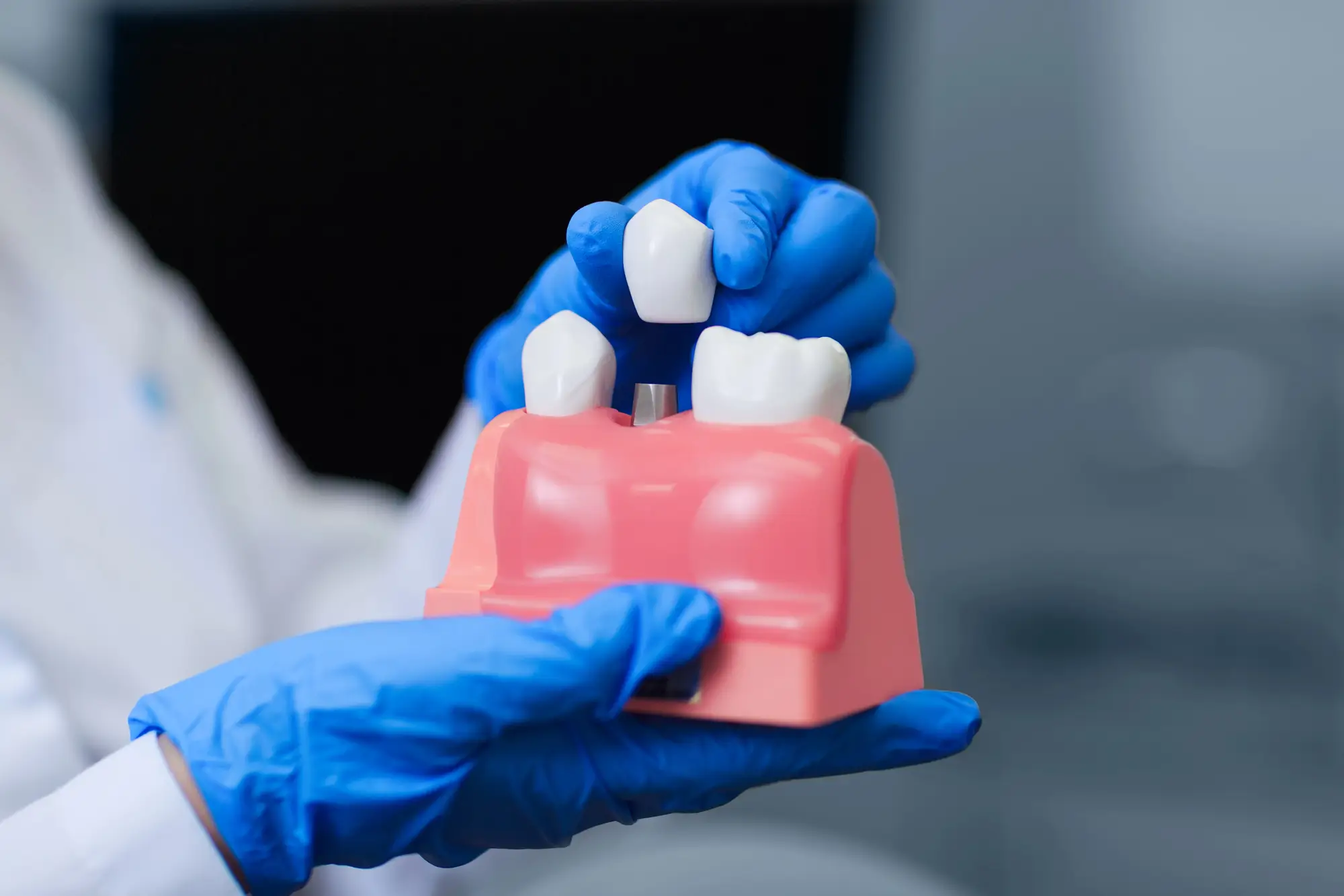 Doctor holding a model for dental implants in Franklinville NJ